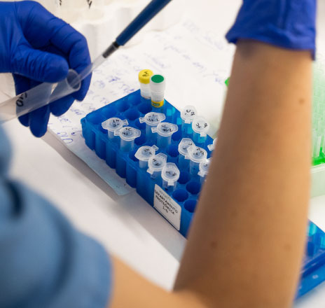 influenza diagnosis